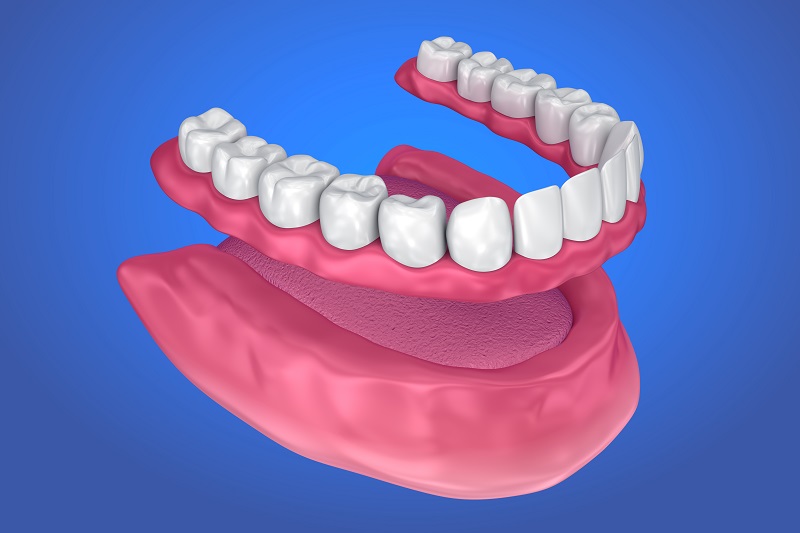 Different Types of Dentures Available For The Comfort Of The Dental Patients
