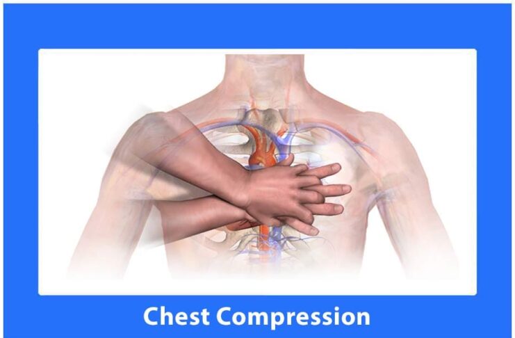 Chest Compression Feedback Device Monitor